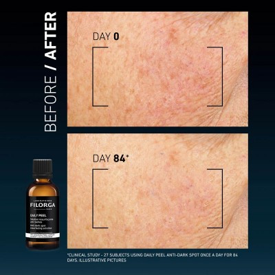 FILORGA - DAILY PEEL [Anti-dark spots] Ресърфейсинг пилинг против тъмни петна 50 ml