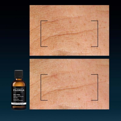 FILORGA - DAILY PEEL [Anti-wrinkle]  Ресърфейсинг пилинг против бръчки 50 ml