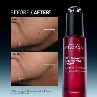 FILORGA - PRO-COLLAGEN MICRO-GROWTH FACTOR Стягащ лифтинг серум 30 ml