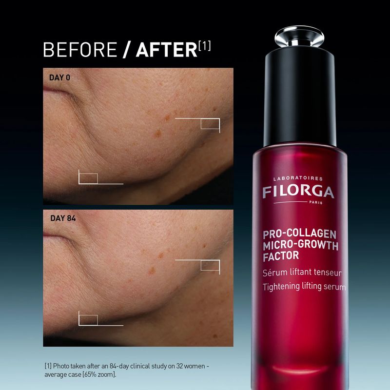 FILORGA - PRO-COLLAGEN MICRO-GROWTH FACTOR Стягащ лифтинг серум 30 ml
