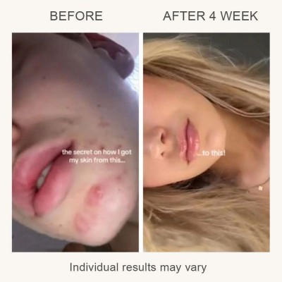 L & L Skin - LUMI LED Light Therapy Skincare Mask LED маска за светлинна терапия
