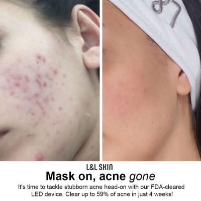 L & L Skin - LUMI LED Light Therapy Skincare Mask LED маска за светлинна терапия