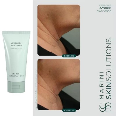 Marini SkinSolutions - Juveneck neck and décolleté cream Крем за шия и деколте против бръчки 50 ml