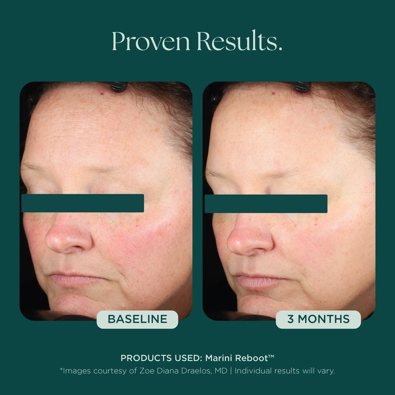 Marini SkinSolutions - Marini Reboot™ PDRN Facial Serum Усъвършенстван регенериращ и подмладяващ серум 30ml