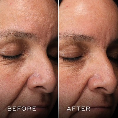 Medik8 - H.E.O.®  Mask Интензивно хидратираща маска