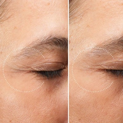 Medik8 - Crystal Retinal® Ceramide Eye 3 Нощен крем за очи с ретиналдехид и серамиди 15 ml