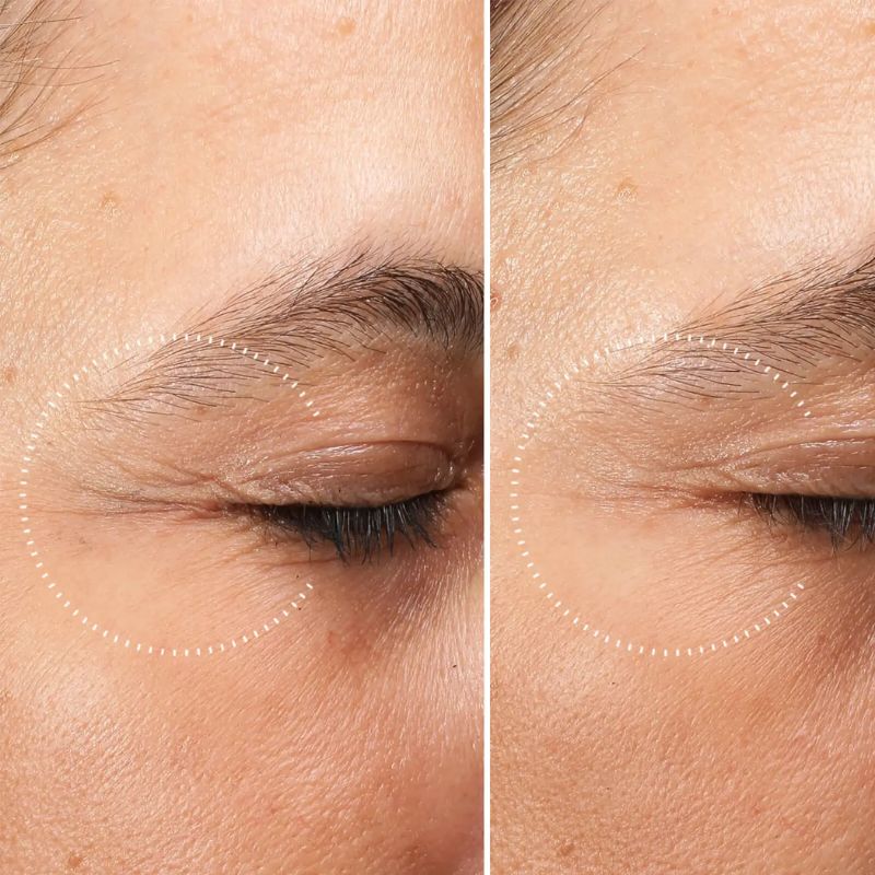Medik8 - Crystal Retinal® Ceramide Eye 3 Нощен крем за очи с ретиналдехид и серамиди 15 ml
