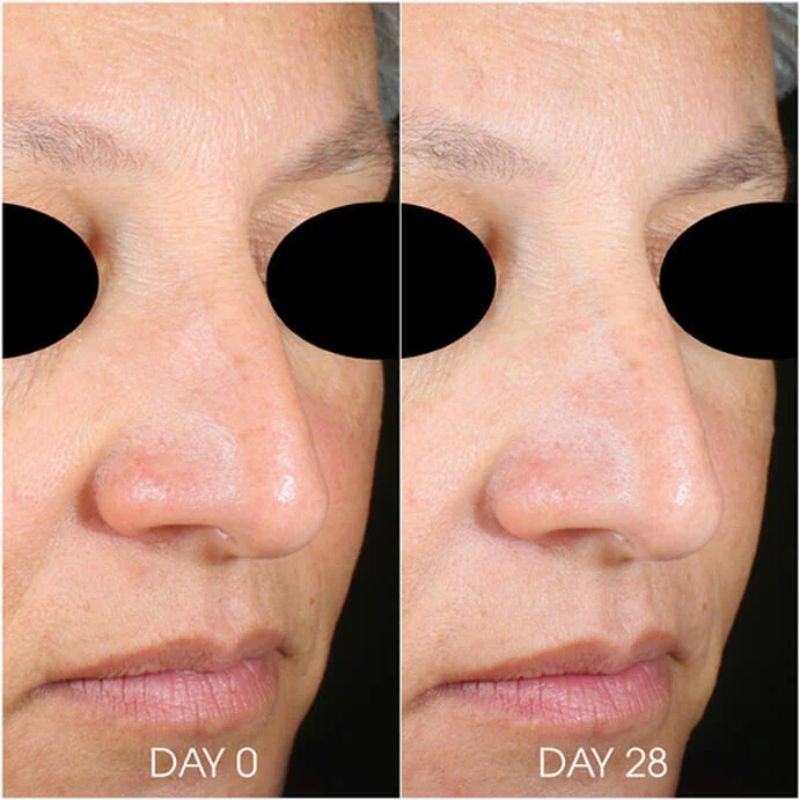 Teoxane® - RHA®️ Hydra Mask Ултрахидратираща и изглаждаща маска 50 ml